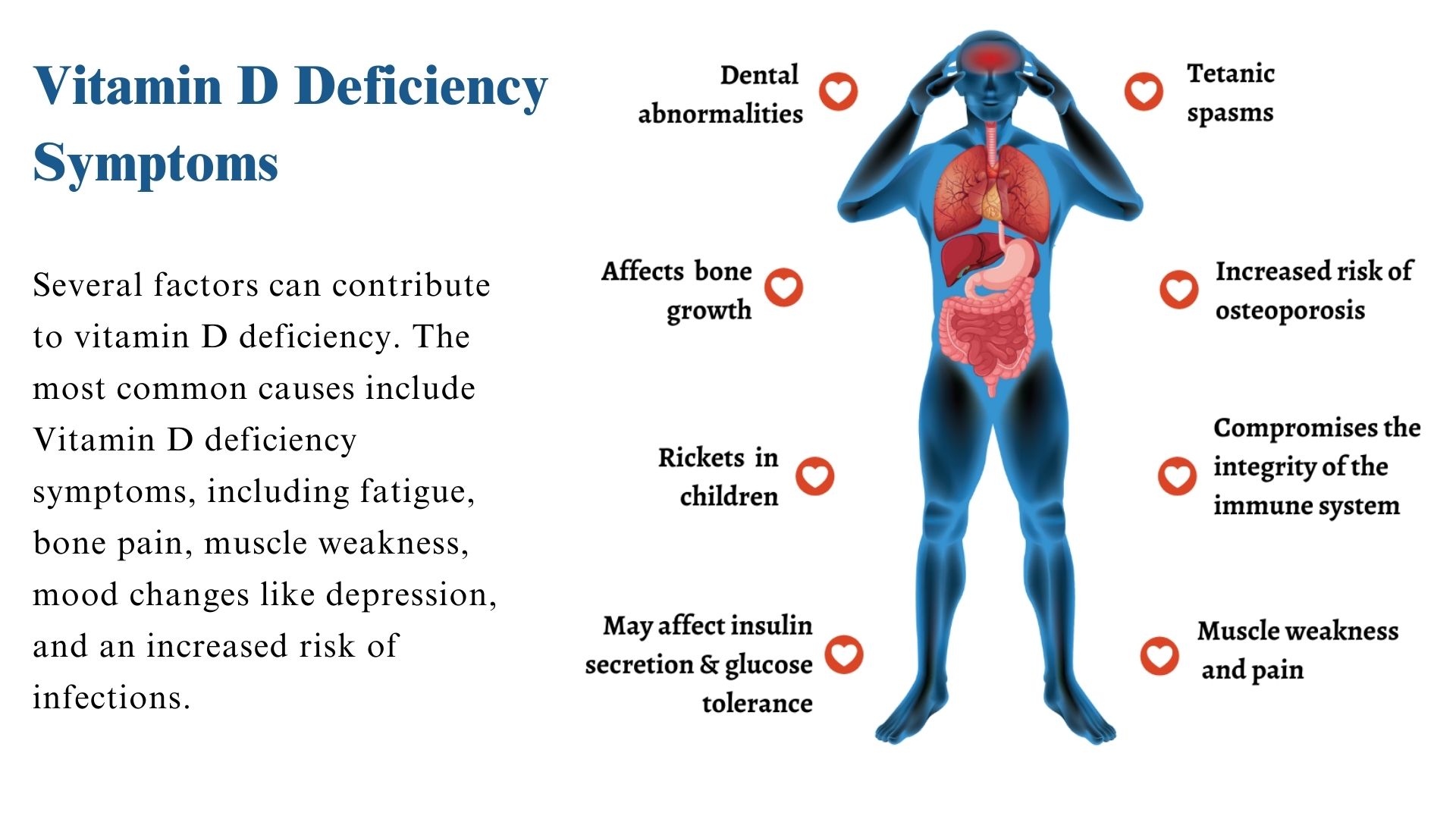 Causes-of-Vitamin-D-Deficiency-A-key-Points All About Vitamin D Injections: How They Work, Dosage, and Side Effects